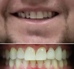 christina-greene-dentistry-before-and-after-photo7