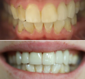 christina-greene-dentistry-before-and-after-photo5